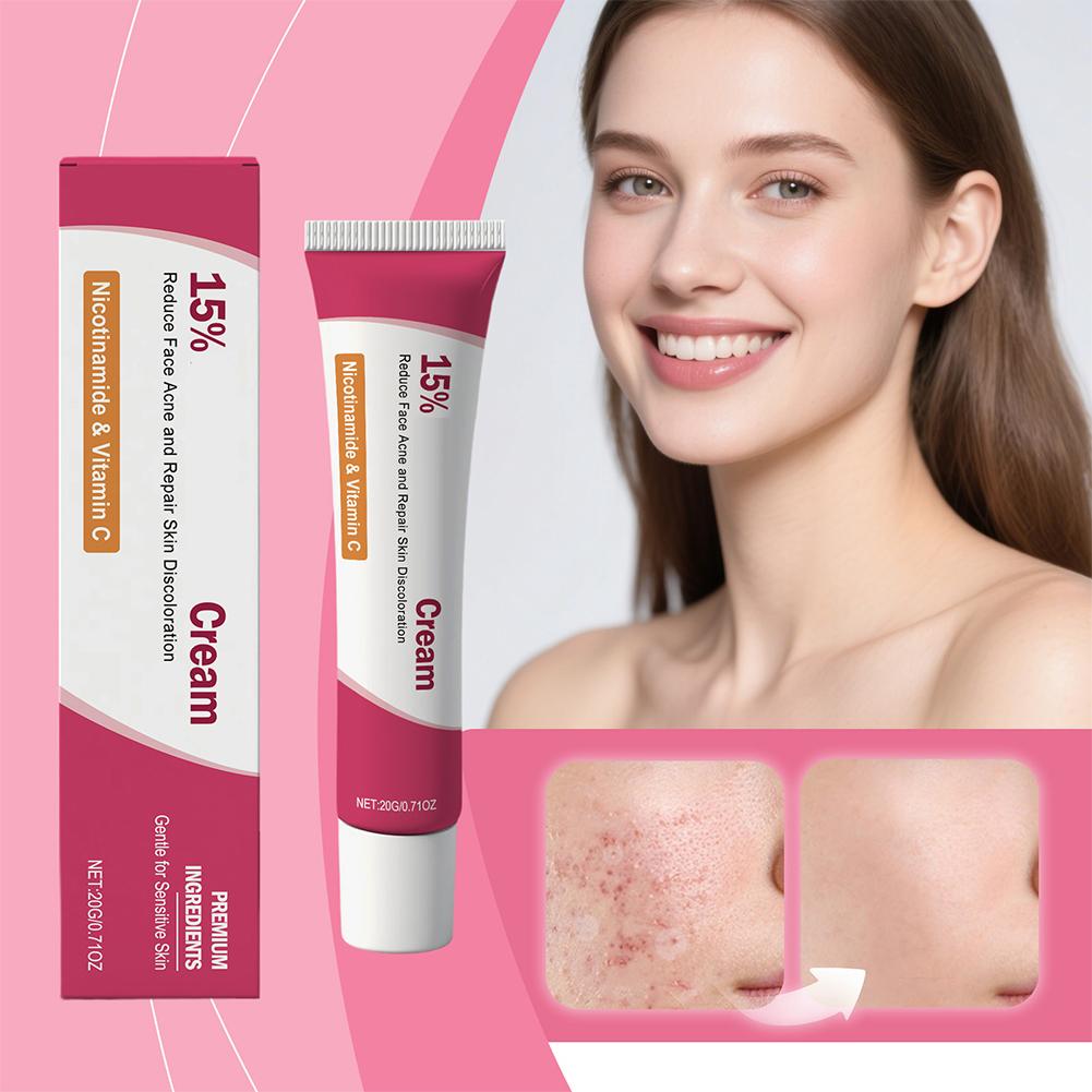 Soothing Acne Treatment Cream, - Skincare Herbal 评论和价格
