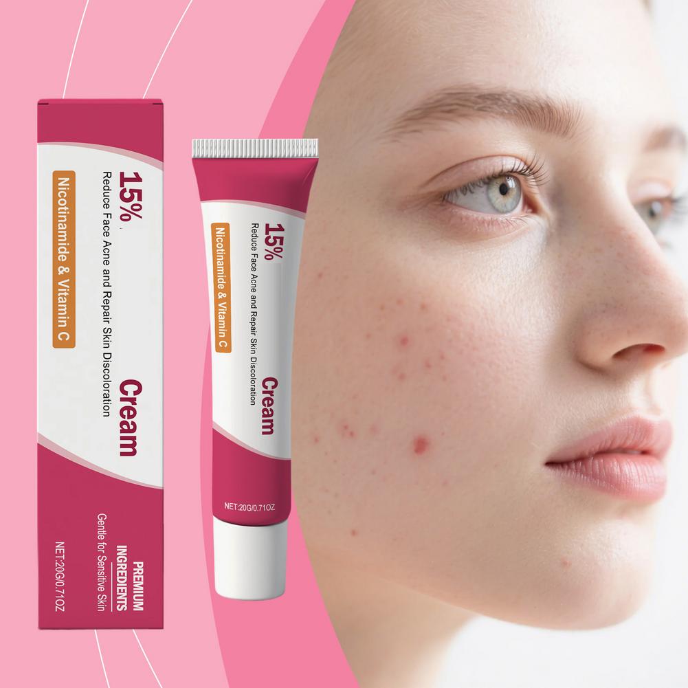 Soothing Acne Treatment Cream, - Skincare Herbal 评论和价格