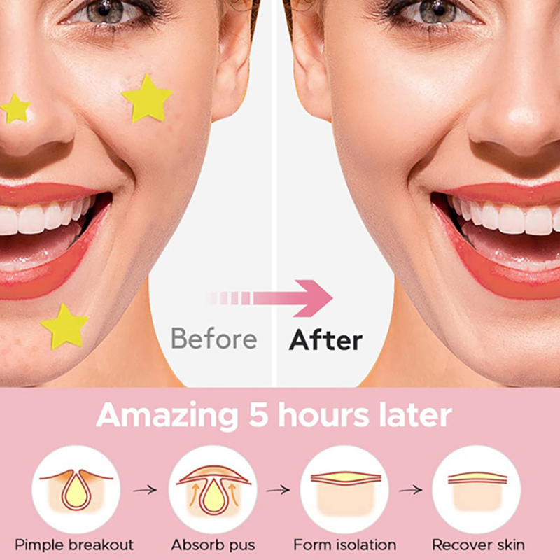 360 Pieces Of Heart Star Face  - Skincare Oil Control 评论和价格